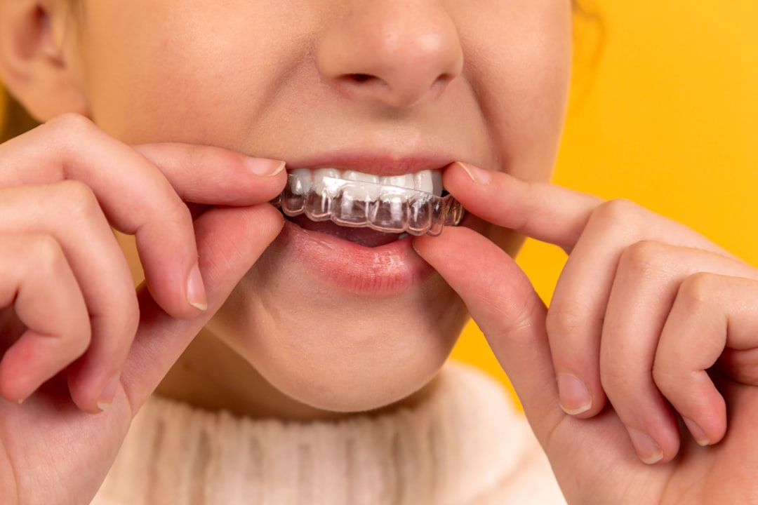 Clear aligners at Care N Cure Dental in Garland TX